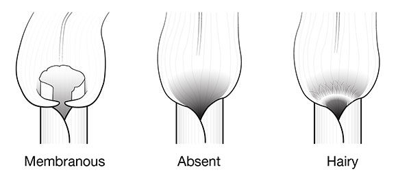 Grass ligule types. 