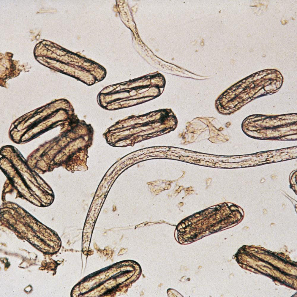 Cereal Cyst Nematode