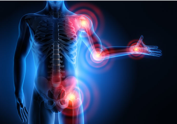 Diagram of body experiencing joint pain