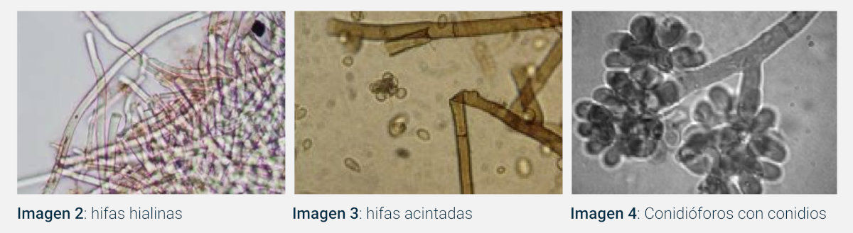 Morfología del hongo